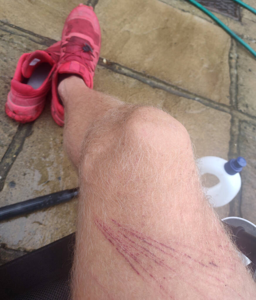 Signs of a great trail run - bramble damage after attempting a bit of a detour on an ultra trail run.